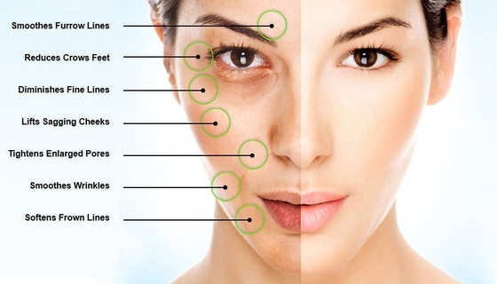 Het kruis verbond Hyaluronic Zuur Laag Poeder - molecuulgewicht 98%